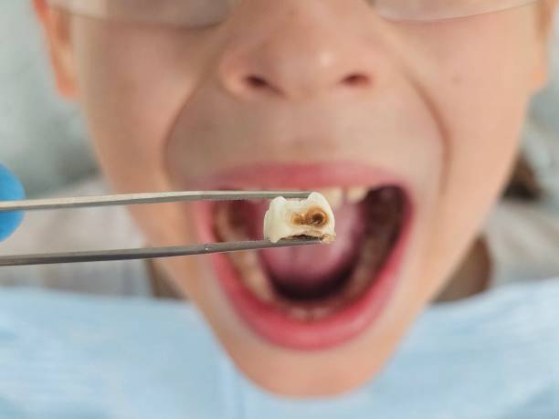 Best Emergency Dental Care for Trauma or Injury in Beaumont, TX
